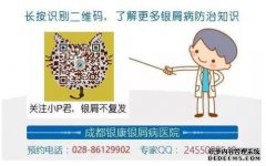 成都银康：如果你患有牛皮癣，你对婚姻和不孕
