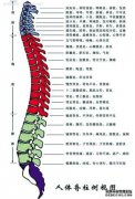 腰椎管狭窄
