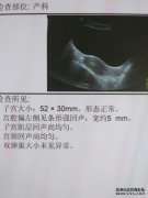 在超声检查中，在胆囊壁上发现了一个稍强的回