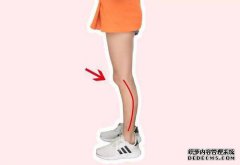 Xo腿如何变成直腿？