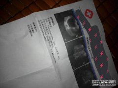[子宫内膜3毫米是什么意思？]
