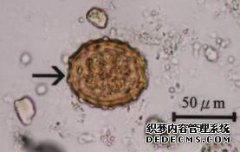 ick粪存储时间测试