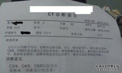 CT电影中通常包含哪些信息？CT电影如何显示？请