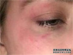[如何防止胡茬掉到我的脸上]