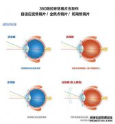 什么是外围模糊镜头？
