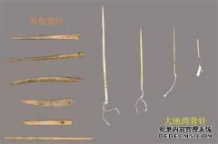CT报告：无右手钩骨骨折，无其他侧面对准