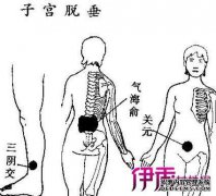 如果有宫殿，我应该使用什么药物？